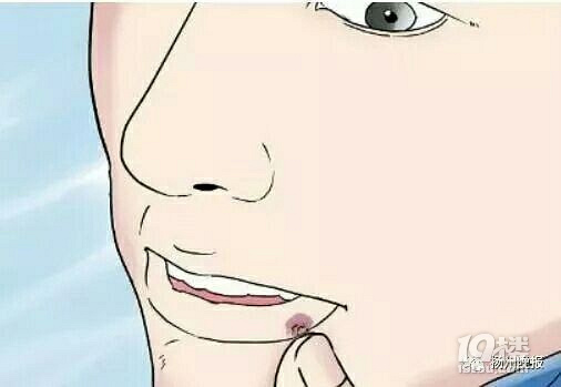 女子熬夜追剧到凌晨2点早晨起来嘴唇肿如