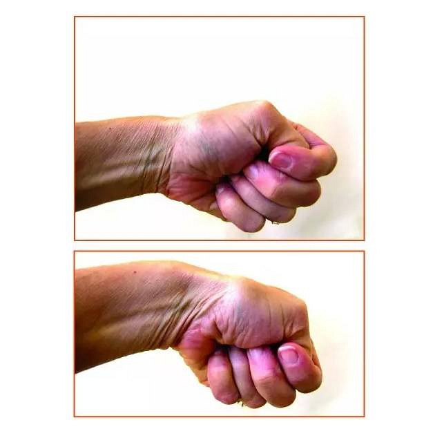 熊黛林产后仅十天就到诊所就医,她的病让无数新手妈妈们直呼:心