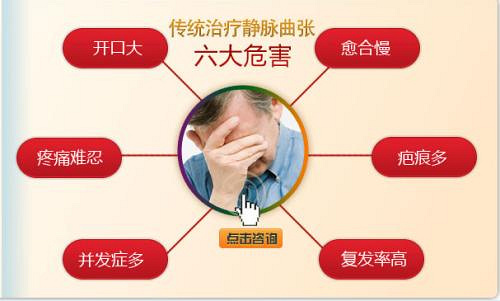 静脉曲张还能治好吗 舒静通专业修复静脉曲张