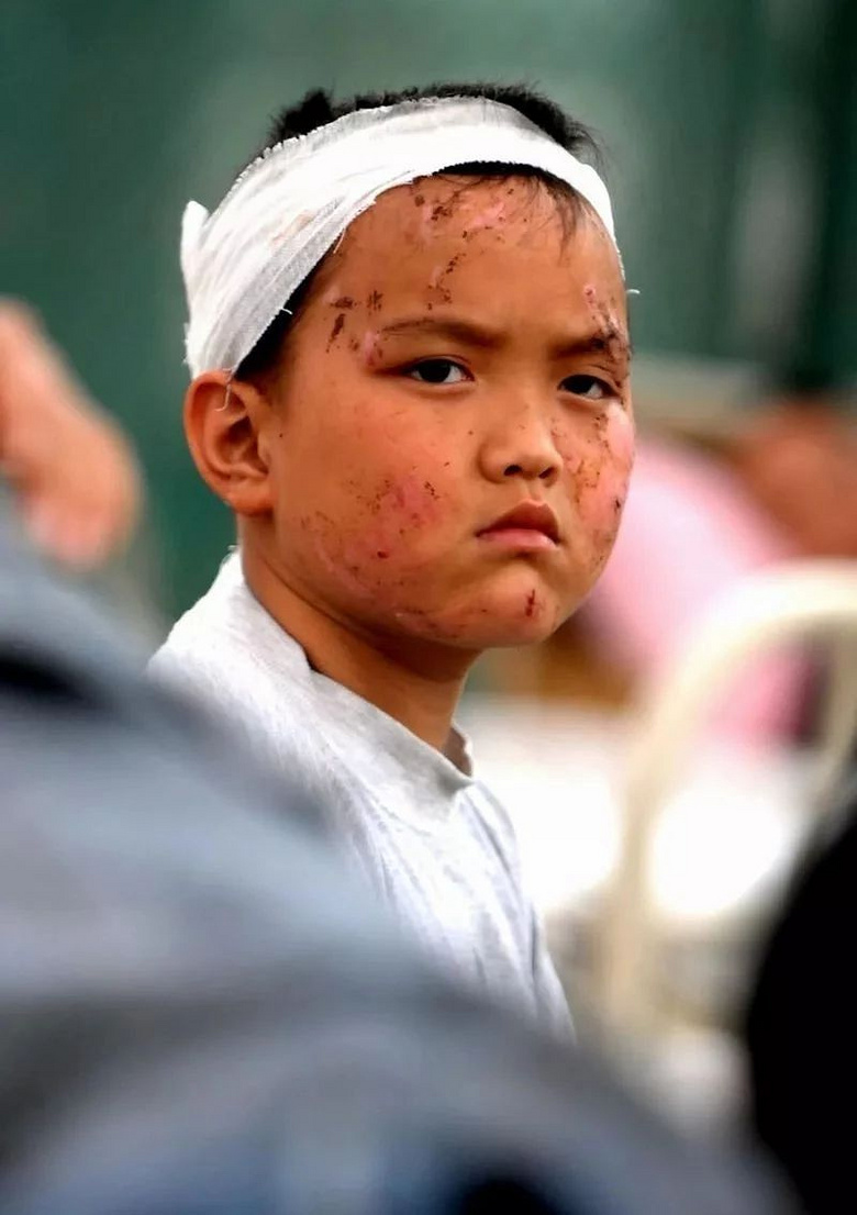 2008年5月17日,绵竹市救助点,一名在地震中受伤的小孩眼睛里满是坚强