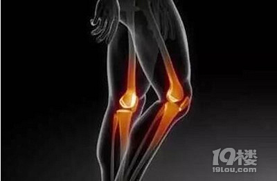 膝盖骨质增生的症状有哪些,需要怎么处理?