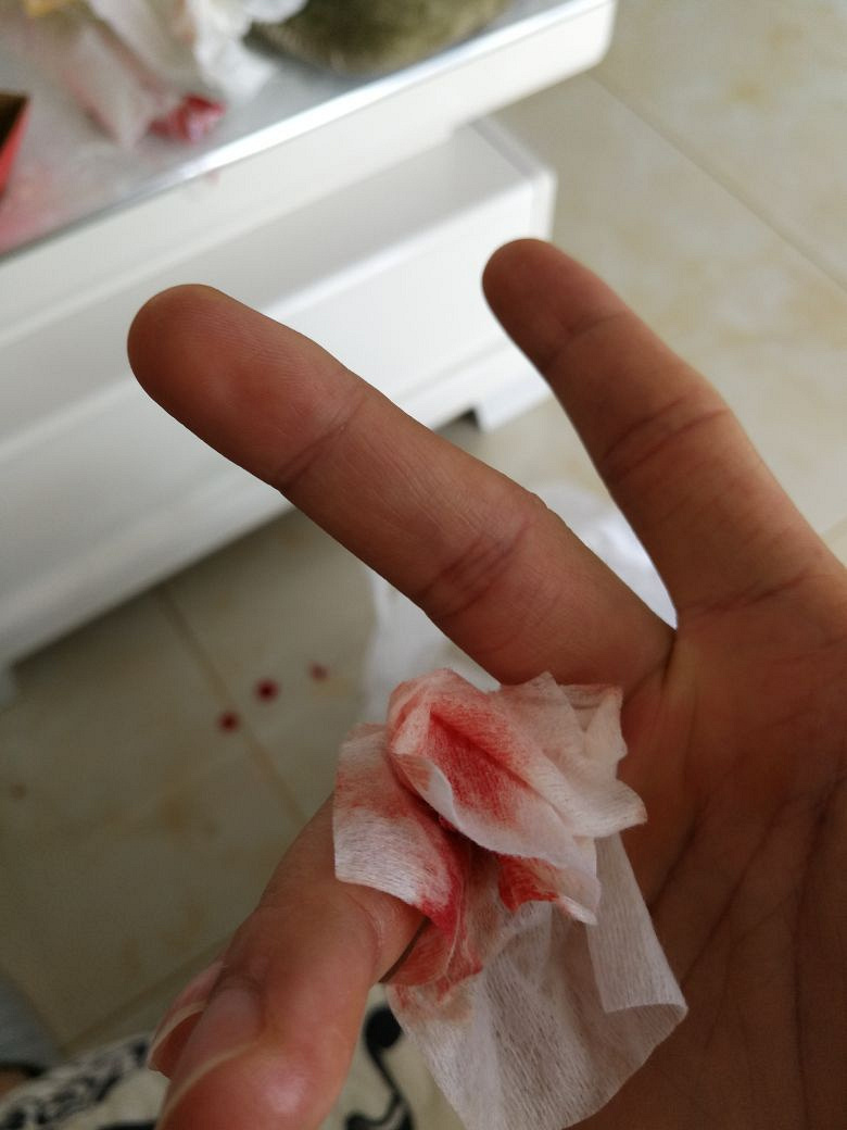 美团最差店家 经常叫外卖的进来看看