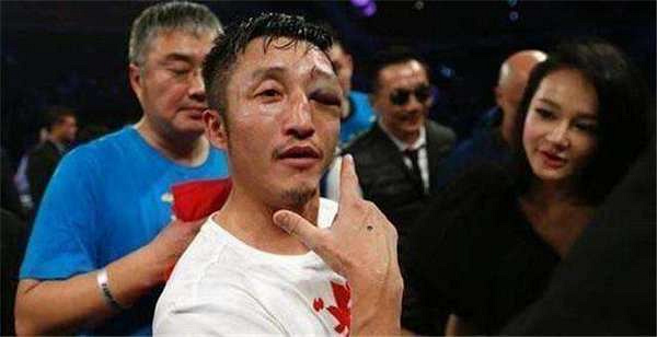 邹市明回应眼疾:不是不想打而伤病让自己无奈