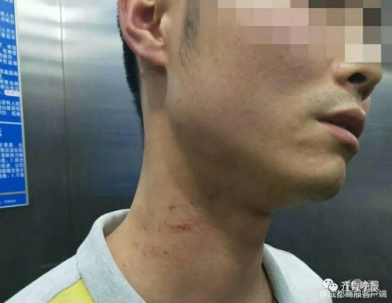 “育你三年,卻換來一頓毒打”高考結(jié)束班主任被家長帶人暴打