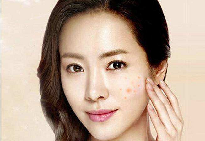 西安画美医疗美容医院-怎么控油去痘印