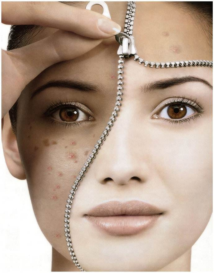 西安画美医疗美容医院-怎么控油去痘印