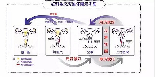 杭州红房子专家解答:为什么妇科炎症这么容易