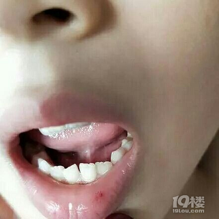 我今天尝到血的味道了!6岁男孩辅导班回家,一