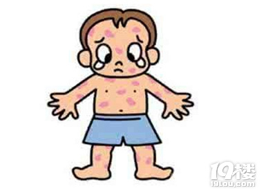 皮肤过敏性紫癜是什么病