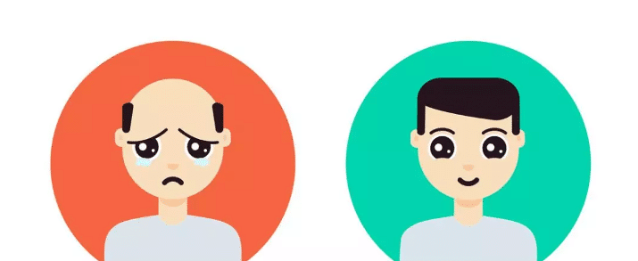 植发后进入脱落期,做好这3三件事,真正拥有长