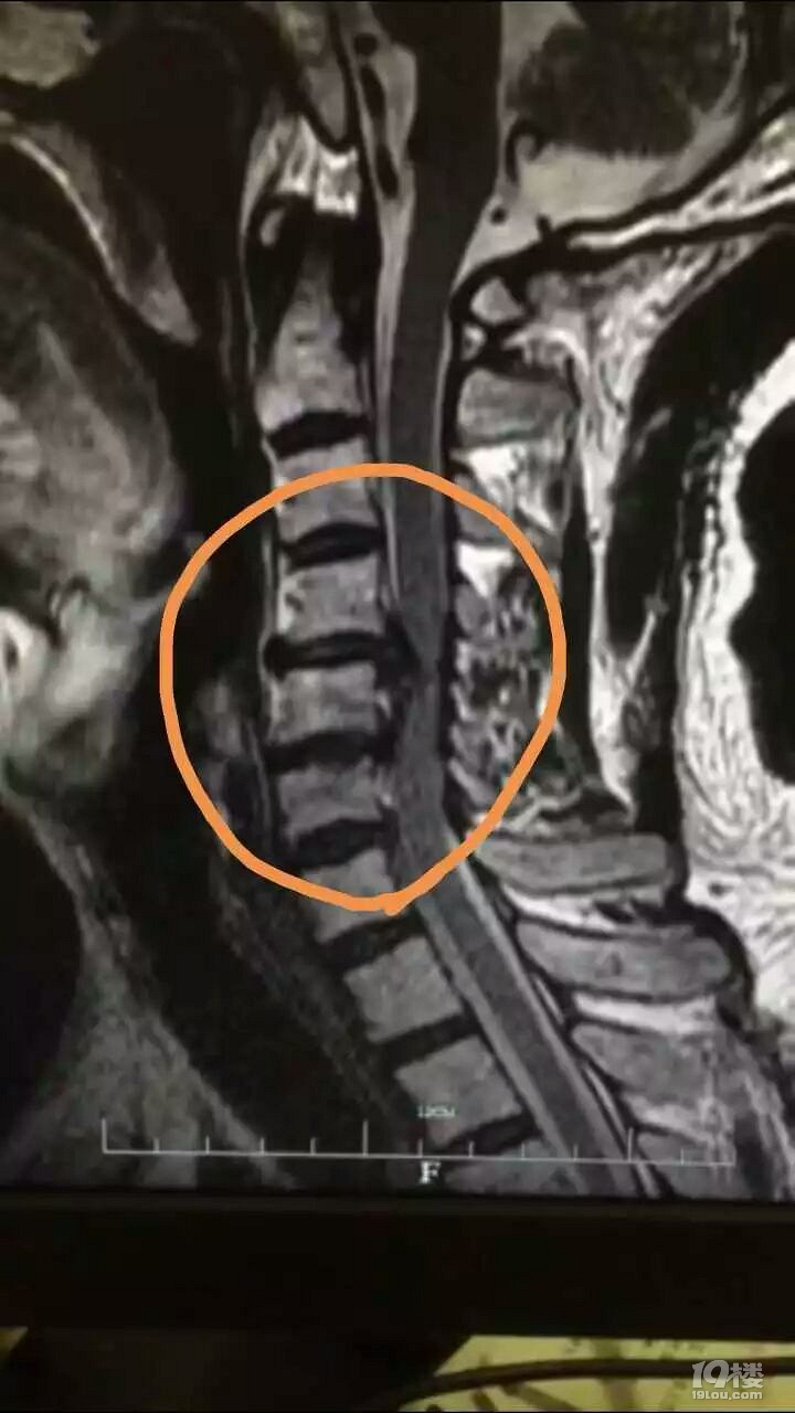 坐火车一路睡到杭州,他下车发现问题严重了!小便都解不出了