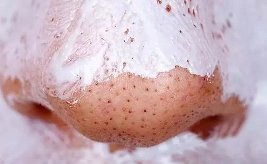 拔出黑头粉刺,地毯式清洁肌肤,还能缩小毛孔!素颜也自带妆容