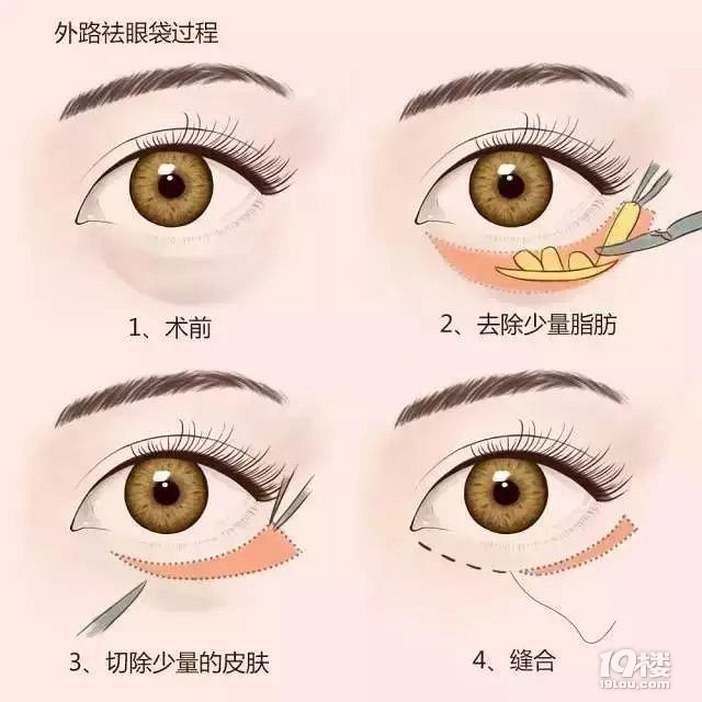 眼袋有多深,你就有多老!