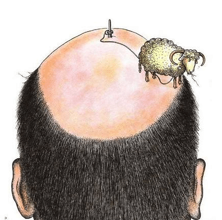 植发取后枕部毛囊,那么后枕部会稀疏么?广州科