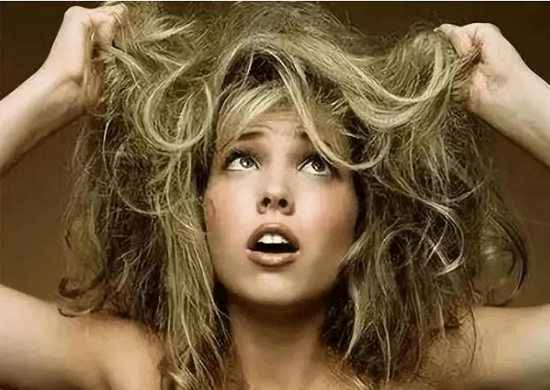 植发后多久能恢复?广州科发源种植头发技术