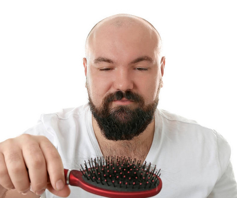 男士应该如何护理自己的头发?深圳下调发际线