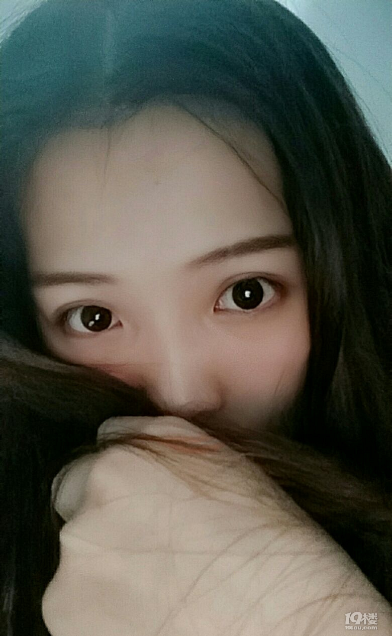 【微整日记】无痕双眼皮第53天