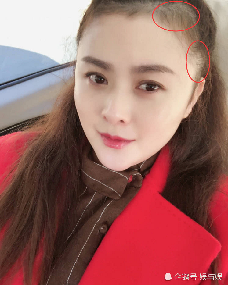 沈腾妻子王琦晒自拍尖下巴抢镜,自曝深受脱发