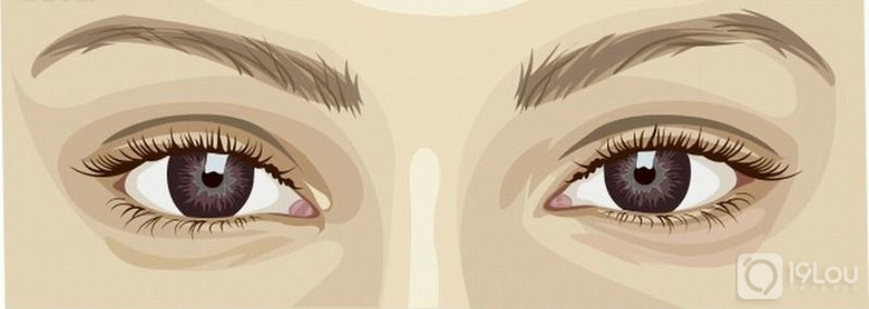 眉毛种植需要经历什么样的生长周期呢?