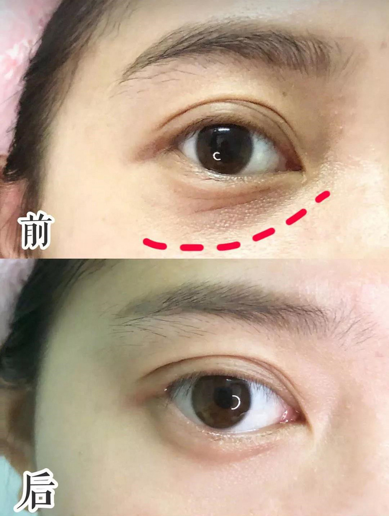 44岁的她跨年晚会力压小花美成仙女!究竟是怎么做到的啊?!-城事-杭州1