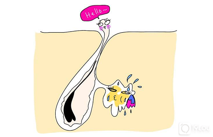 毛囊萎缩和闭合有什么区别,如何解决?