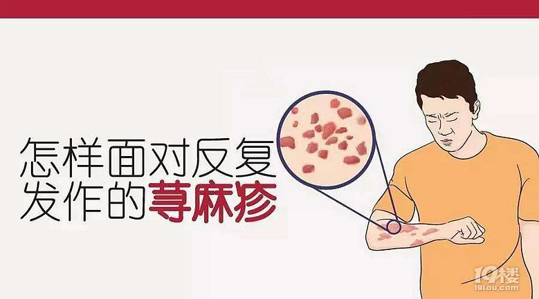 荨麻疹皮肤病简单护理方法