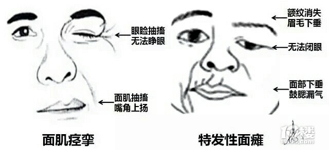 杭州大妈左眼狂跳，以为自己有多大的财要来，结果医生说…