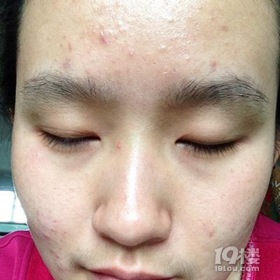 对于毛孔粗大泛红得敏感肌推荐好用的护肤品有哪些?