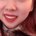 【隐形牙套日记】时代天使和隐适美的区别有多大？30岁女生侧颜杀_图3