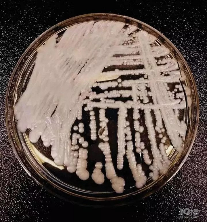 中国确诊18例超级真菌感染,致死率达60
