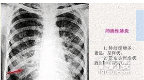 ӲƤl(f)YЩF(xin)l(f)Yo(h)