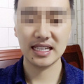 31岁了，还可以矫正牙齿吗？