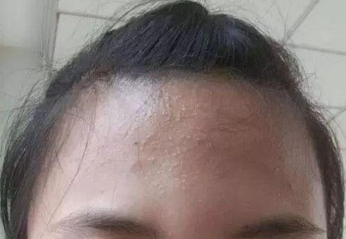 热巴吃货人设崩但我更关心她怎么解决了脸部油腻又粗糙的问题