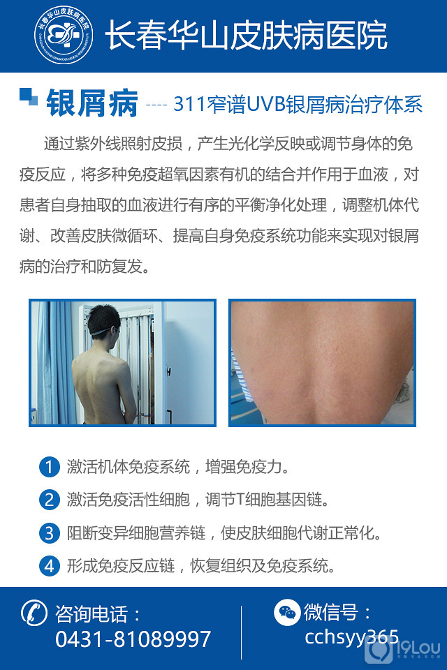 看银屑病哪家医院好
