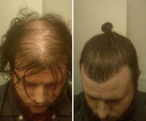 但终有一天tony老师也无法挽回你成为一颗「卤蛋」头.