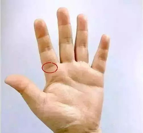 捏食指根部外侧部位可以有效缓解失眠症状