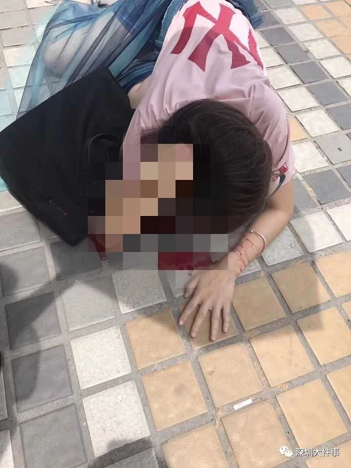 这重物也能掉下?女子路过被砸中头部