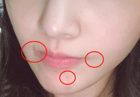 郑爽素颜自拍曝光皮肤超细腻,嘴角的疤和下巴的痘痘亮