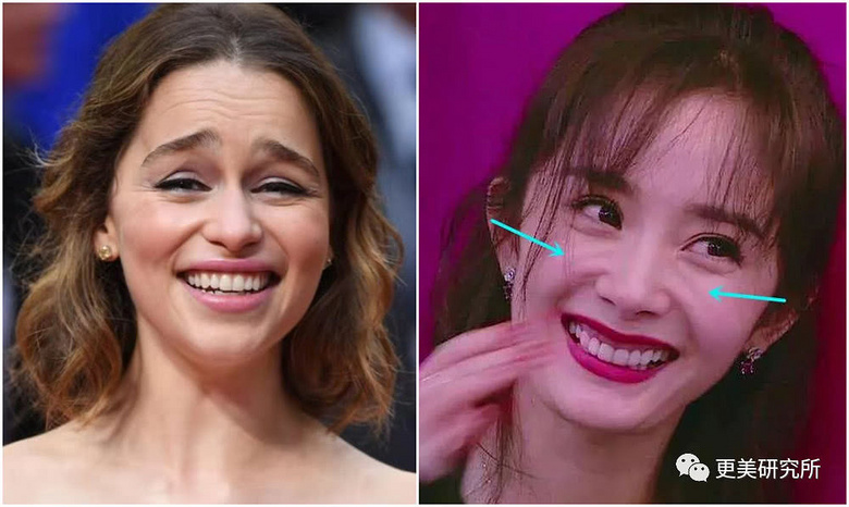 灵气比肩周迅的小花整形过度笑起来满脸沟壑,杨紫也可能步后尘