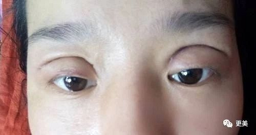 整容日记-杭州19楼