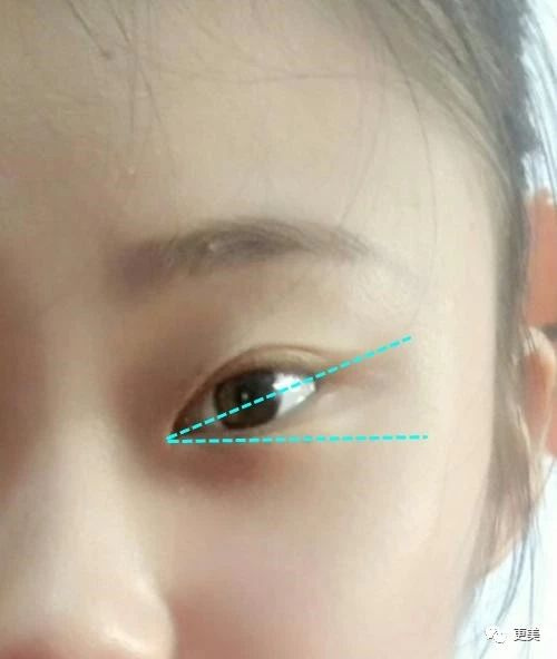 整容日记-杭州19楼