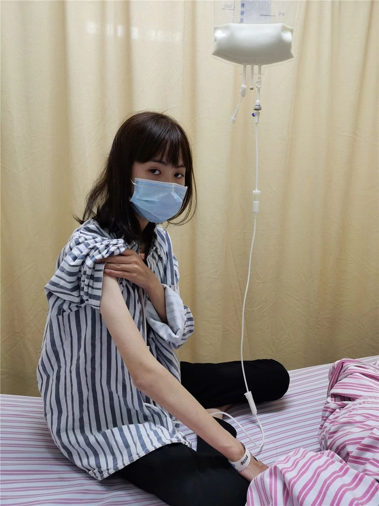 很明显,这是继发营养不良的表现.