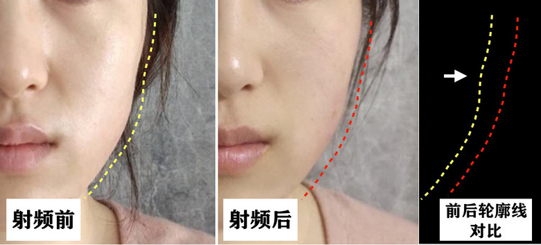 这届年轻人更好看了吗？为何好看小花变多，但惊艳美人却变少？