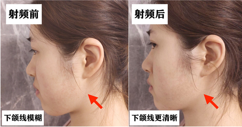 这届年轻人更好看了吗？为何好看小花变多，但惊艳美人却变少？