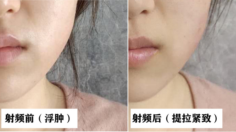 这届年轻人更好看了吗？为何好看小花变多，但惊艳美人却变少？