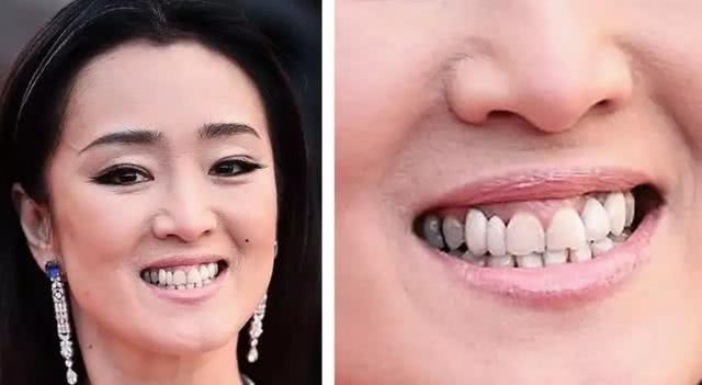 吴昕牙龈发黑热巴显老,陈瑶包不住嘴