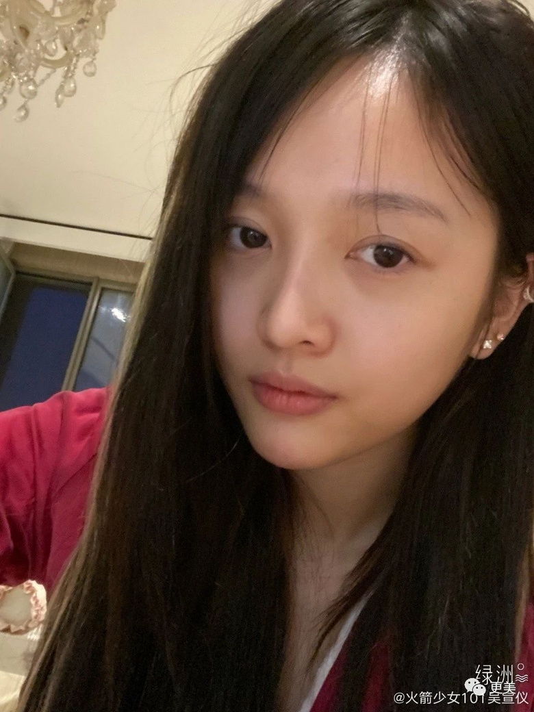 吴宣仪素颜暴露之前整形痕迹,少女感又回来了!-整容日记-杭州19楼