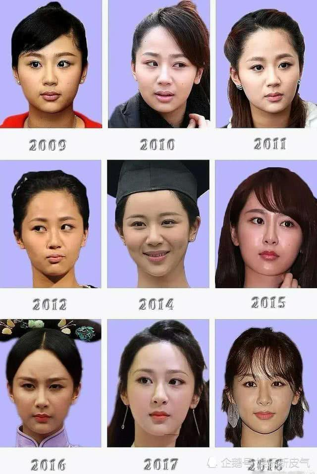 真的整过容?杨紫发动态被吐槽脸不自然,10年照片对比变化有多