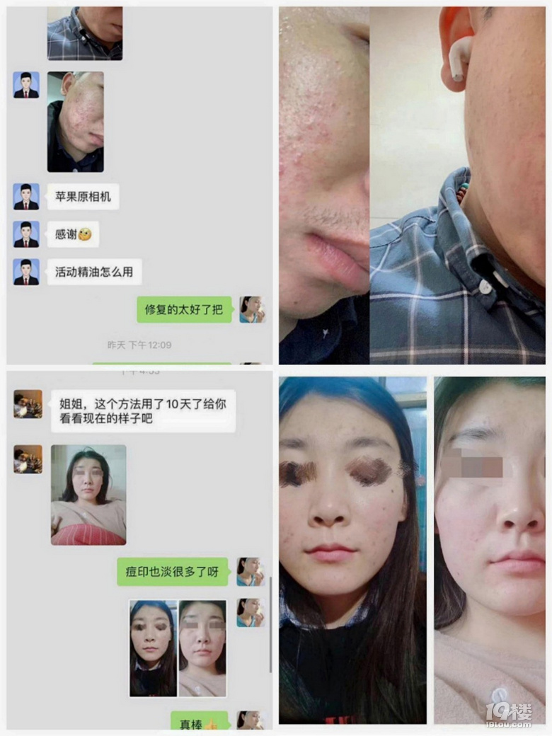 章夏手记-一入祛痘深似海,从此钱包是路人