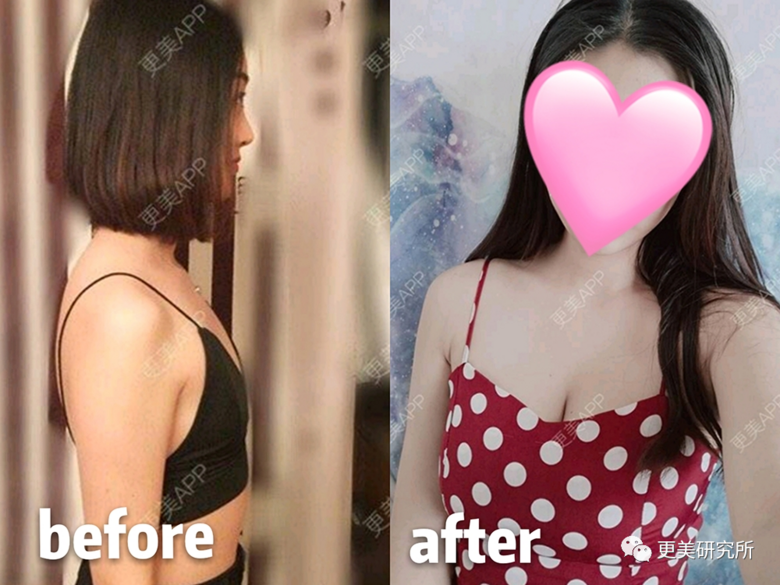 继宋祖儿催吐疤痕都露出后，泫雅热巴的尤物身材是这样来的？